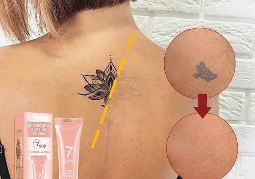 best tattoo removal creams